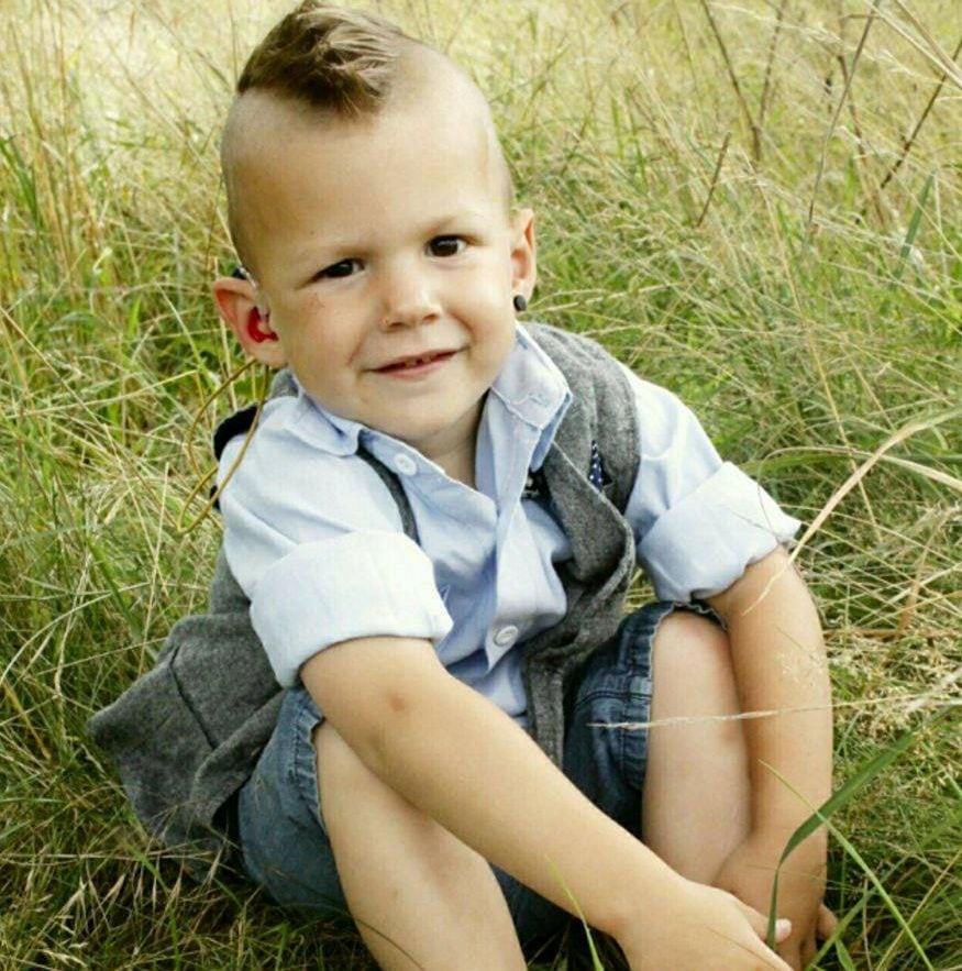 Maddox Ushersyndroom
